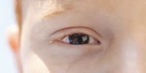baixa-visao-na-infancia:-especialista-alerta-para-diagnostico-precoce
